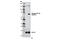 Lymphocyte Cytosolic Protein 2 antibody, 13177S, Cell Signaling Technology, Western Blot image 