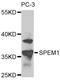 Spermatid maturation protein 1 antibody, STJ110379, St John