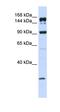 ATP Binding Cassette Subfamily A Member 5 antibody, orb330336, Biorbyt, Western Blot image 