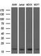 Actin Related Protein 2/3 Complex Subunit 5 antibody, MA5-26193, Invitrogen Antibodies, Western Blot image 