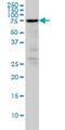 Radixin antibody, H00005962-M03, Novus Biologicals, Western Blot image 