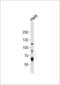 Proprotein Convertase Subtilisin/Kexin Type 9 antibody, 62-831, ProSci, Western Blot image 