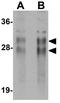 Cysteine Rich Secretory Protein 2 antibody, GTX85002, GeneTex, Western Blot image 