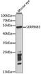 Serpin Family B Member 3 antibody, GTX32866, GeneTex, Western Blot image 