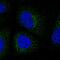 Collagen Type VIII Alpha 1 Chain antibody, PA5-62731, Invitrogen Antibodies, Immunofluorescence image 