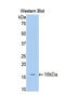 Interleukin 18 Receptor 1 antibody, LS-C294872, Lifespan Biosciences, Western Blot image 