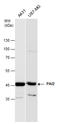 Serpin Family B Member 2 antibody, GTX103194, GeneTex, Western Blot image 