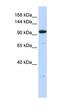 Zinc Finger Protein 112 antibody, orb324773, Biorbyt, Western Blot image 