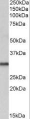 Voltage Dependent Anion Channel 2 antibody, orb18662, Biorbyt, Western Blot image 