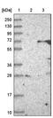 Zinc Finger Protein 426 antibody, PA5-56117, Invitrogen Antibodies, Western Blot image 