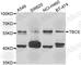 Tubulin Folding Cofactor E antibody, A7453, ABclonal Technology, Western Blot image 