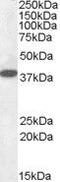 Laforin antibody, PA5-18944, Invitrogen Antibodies, Western Blot image 