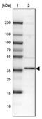 Phosphatidylserine Synthase 1 antibody, NBP1-83060, Novus Biologicals, Western Blot image 