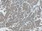 Myeloid Leukemia Factor 1 antibody, 13100-1-AP, Proteintech Group, Immunohistochemistry paraffin image 