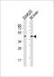 Sterol O-acyltransferase 1 antibody, MBS9206604, MyBioSource, Western Blot image 