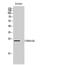 Cytochrome B561 Family Member D2 antibody, A13899, Boster Biological Technology, Western Blot image 