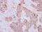 KDEL  antibody, PA5-29705, Invitrogen Antibodies, Immunohistochemistry paraffin image 