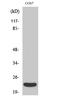 Lymphotoxin Alpha antibody, STJ96056, St John