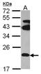 Trans-Golgi Network Vesicle Protein 23 Homolog B antibody, NBP1-31988, Novus Biologicals, Western Blot image 