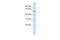 Zinc Finger Protein 419 antibody, A15530, Boster Biological Technology, Western Blot image 