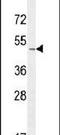 Selectin P Ligand antibody, PA5-23970, Invitrogen Antibodies, Western Blot image 