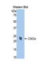 Interleukin 1 Receptor Type 1 antibody, LS-C294812, Lifespan Biosciences, Western Blot image 