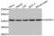 Ubiquinol-Cytochrome C Reductase Core Protein 1 antibody, abx002384, Abbexa, Western Blot image 