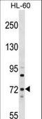 Myotubularin Related Protein 6 antibody, LS-C164668, Lifespan Biosciences, Western Blot image 
