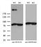 Nuclear envelope pore membrane protein POM 210 antibody, M05308, Boster Biological Technology, Western Blot image 