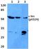 SRC Proto-Oncogene, Non-Receptor Tyrosine Kinase antibody, A00107Y529, Boster Biological Technology, Western Blot image 