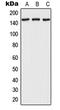 RNA Polymerase II Associated Protein 1 antibody, GTX55944, GeneTex, Western Blot image 