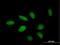 Tetratricopeptide Repeat Domain 23 antibody, H00064927-B01P, Novus Biologicals, Immunocytochemistry image 