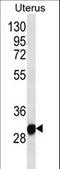 Ring Finger Protein 148 antibody, LS-C162649, Lifespan Biosciences, Western Blot image 