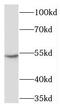X-Linked Inhibitor Of Apoptosis antibody, FNab09541, FineTest, Western Blot image 