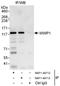 WW Domain Containing E3 Ubiquitin Protein Ligase 1 antibody, NBP1-49713, Novus Biologicals, Immunoprecipitation image 
