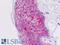 Epithelial membrane protein 2 antibody, LS-B8772, Lifespan Biosciences, Immunohistochemistry paraffin image 