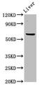 5'-Nucleotidase, Cytosolic II antibody, LS-C673416, Lifespan Biosciences, Western Blot image 