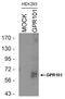 G Protein-Coupled Receptor 101 antibody, PA3-045, Invitrogen Antibodies, Western Blot image 