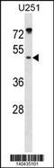 ILK Associated Serine/Threonine Phosphatase antibody, 60-521, ProSci, Western Blot image 