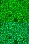 Nuclear Factor Kappa B Subunit 2 antibody, LS-C746896, Lifespan Biosciences, Immunofluorescence image 