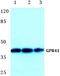 Free Fatty Acid Receptor 3 antibody, A02437-1, Boster Biological Technology, Western Blot image 