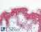 Vacuolar protein sorting-associated protein 13B antibody, LS-B8840, Lifespan Biosciences, Immunohistochemistry frozen image 