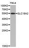 Solute Carrier Family 18 Member A2 antibody, A02232, Boster Biological Technology, Western Blot image 