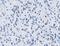 Metastasis Associated 1 Family Member 2 antibody, A03073-1, Boster Biological Technology, Immunohistochemistry frozen image 