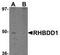 Rhomboid Domain Containing 1 antibody, TA306890, Origene, Western Blot image 