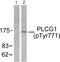 1-phosphatidylinositol-4,5-bisphosphate phosphodiesterase gamma-1 antibody, PA5-38090, Invitrogen Antibodies, Western Blot image 