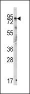 GIT ArfGAP 1 antibody, PA5-14313, Invitrogen Antibodies, Western Blot image 