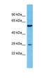 Transmembrane Serine Protease 11E antibody, orb331398, Biorbyt, Western Blot image 