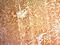 Glypican 3 antibody, NBP2-48396, Novus Biologicals, Immunohistochemistry paraffin image 