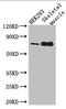 Tudor Domain Containing 3 antibody, LS-C679769, Lifespan Biosciences, Western Blot image 